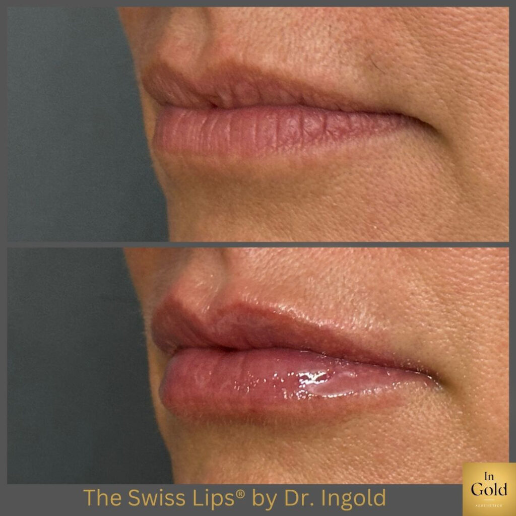 Swiss Lips 1