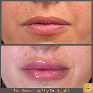 The Swiss Lips J.r.2