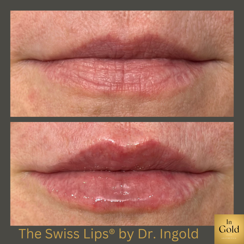 The Swiss Lips1