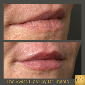 The Swiss Lips2