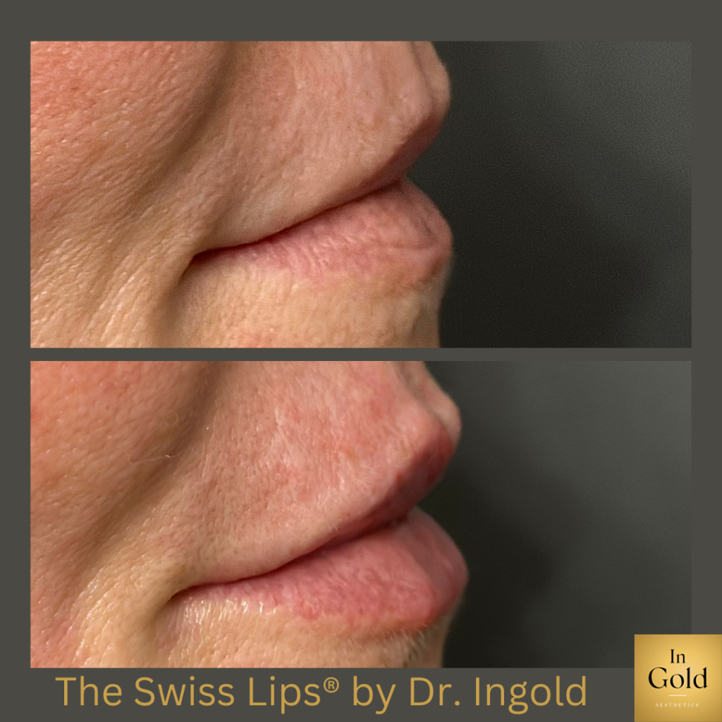 The Swiss Lips3