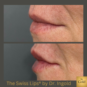 The Swiss Lips4