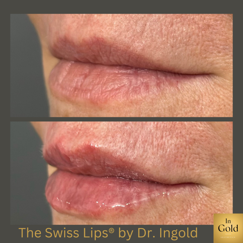 The Swiss Lips5